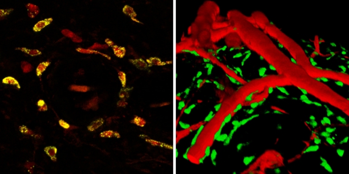 mast cells_collage